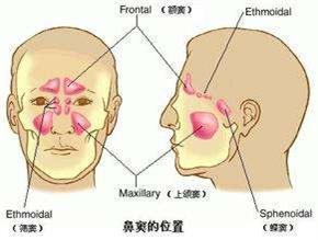 西安鼻息肉病发原因有哪些?